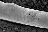 5 – Immagine al S.E.M. di un intergeniculum con concettacoli